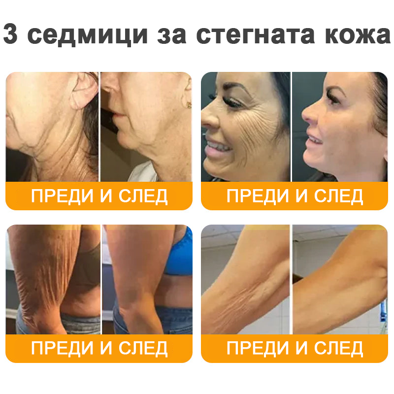 VLSVLS® Крем с пчелна отрова за регенерация на кожата (👨⚕️ подходящ за всички възрастови групи, препоръчан от AAD) 🎁