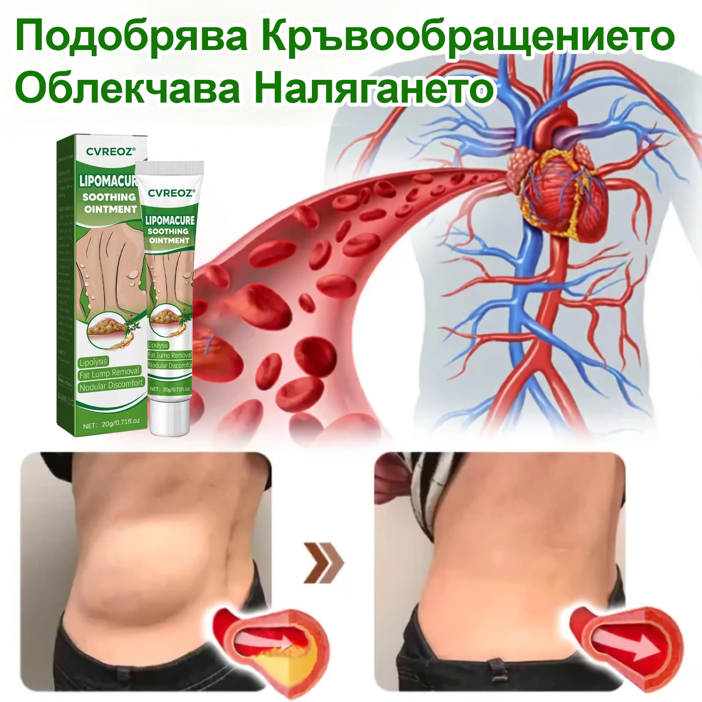 Cvreoz® Успокояващ мехлем за липоми
