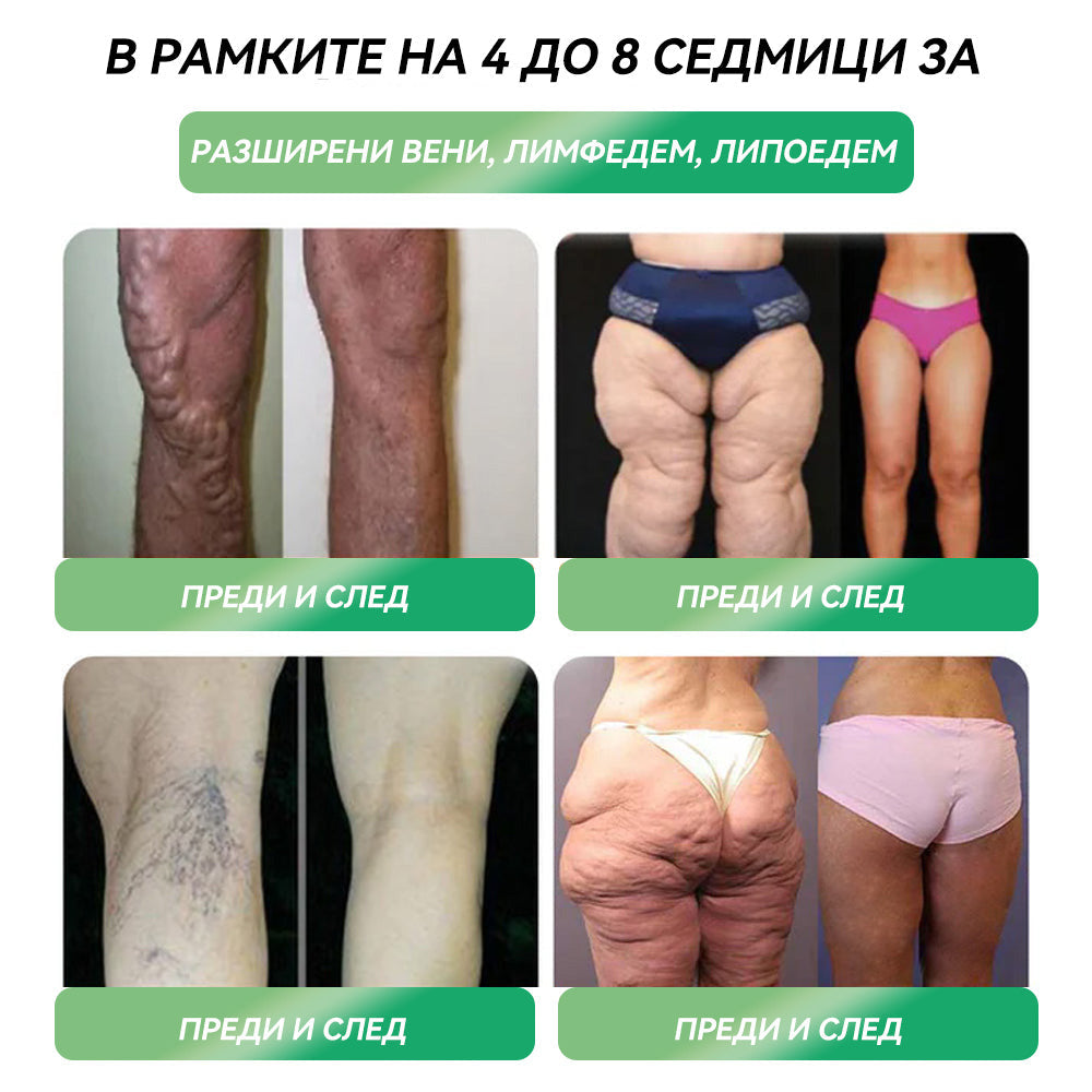 ✅ Препоръчано от над 100 000 души| официален магазин | 𝑆𝑇𝐷𝐸𝐼® 👩⚕️👩⚕️ 𝐺𝐿𝑃-1 Отслабване Орален разтвор - Затлъстяване, сърдечно-съдови заболявания, диабет, сънна апнея, проблеми със ставите и други