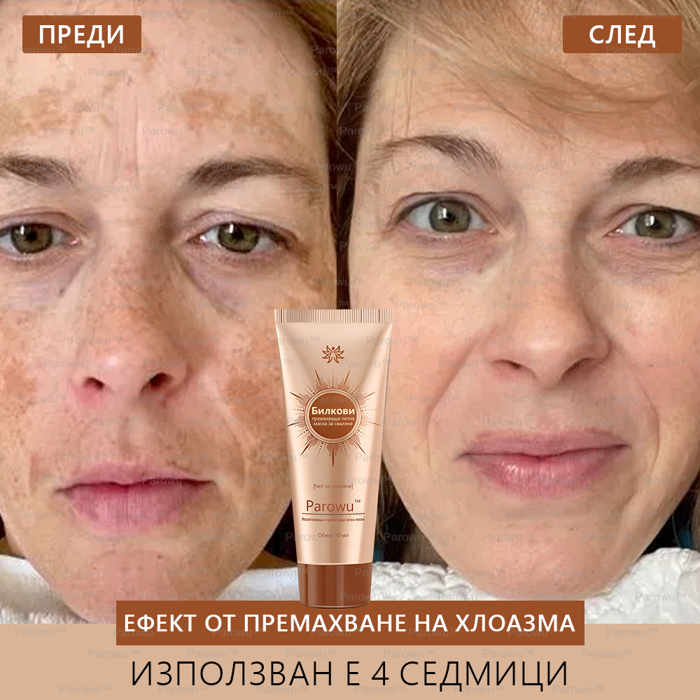 Parowu™ Изсветляваща и премахваща петна маска - 💗Натурални съставки за дълготрайно премахване на петна, хиперпигментации и слънчеви петна