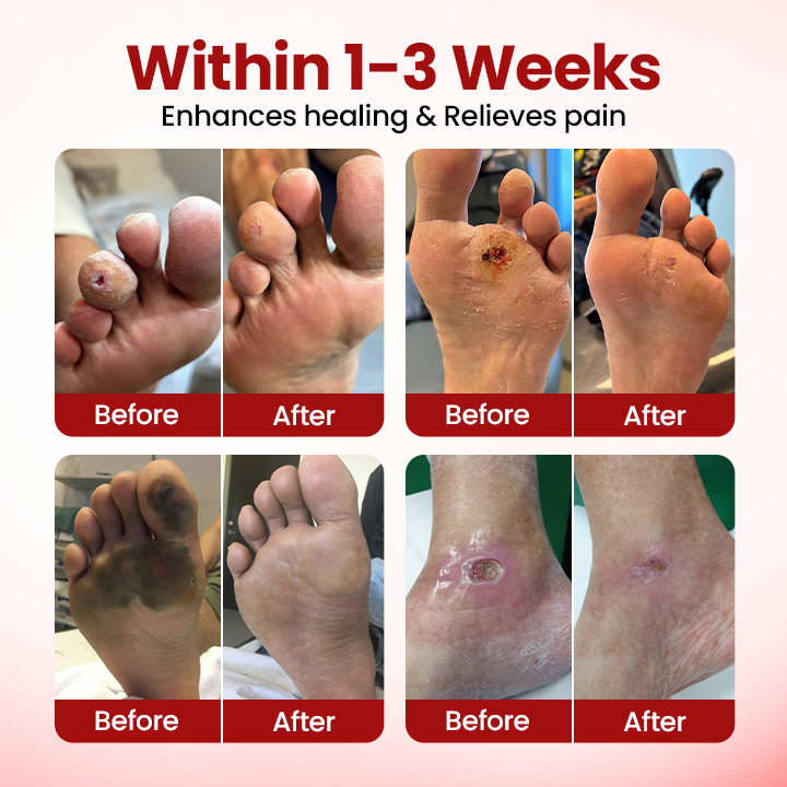 Timilk® VitaGluco Крем за грижа при диабет