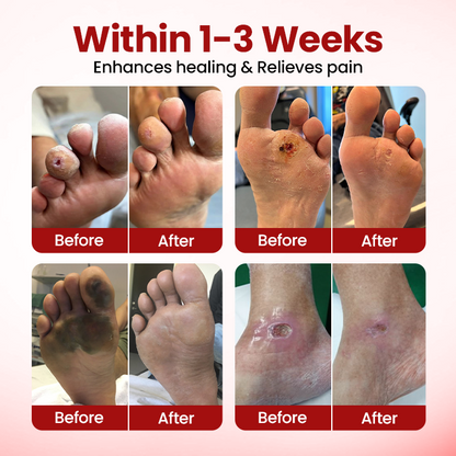 Timilk® VitaGluco Крем за грижа при диабет