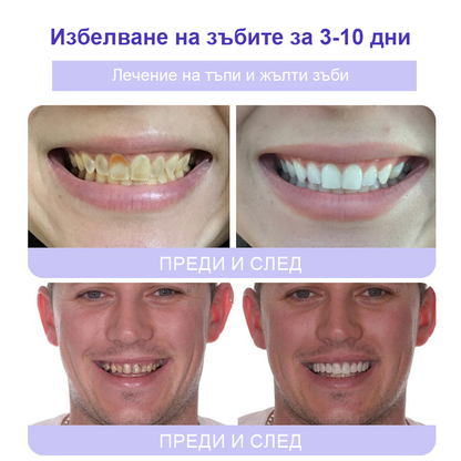 Cvreoz® (ADA recommended) Teeth Restoration Mineral Powder (🦷𝐋𝐢𝐦𝐢𝐭𝐞𝐝 𝐭𝐢𝐦𝐞 𝐝𝐢𝐬𝐜𝐨𝐮𝐧𝐭 𝐋𝐚𝐬𝐭 𝟑𝟎 𝐦𝐢𝐧𝐮𝐭𝐞𝐬🦷)💎