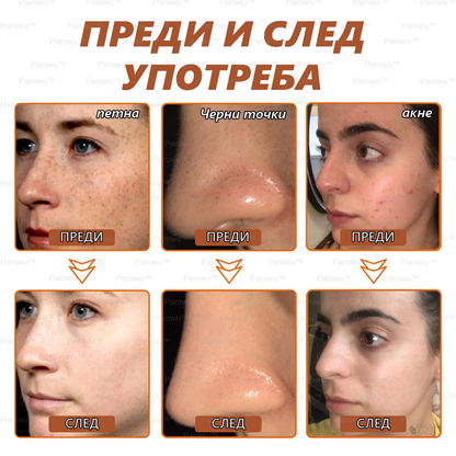 Parowu™ Изсветляваща и премахваща петна маска - 💗Натурални съставки за дълготрайно премахване на петна, хиперпигментации и слънчеви петна