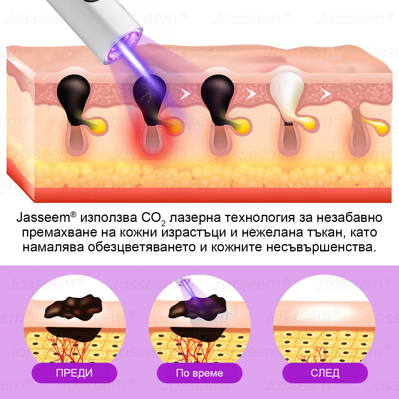 𝐉𝐚𝐬𝐬𝐞𝐞𝐦® Усъвършенствана неинвазивна CO₂ лазерна писалка за възстановяване на кожата 💕 (Нежно премахва брадавици, родилни белези, старчески петна и кожни образувания - без болка, без притеснения!)
