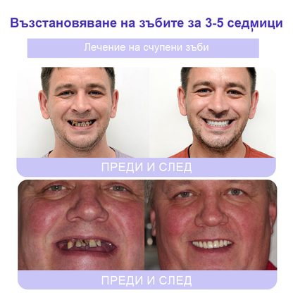 Cvreoz® (ADA recommended) Teeth Restoration Mineral Powder (🦷𝐋𝐢𝐦𝐢𝐭𝐞𝐝 𝐭𝐢𝐦𝐞 𝐝𝐢𝐬𝐜𝐨𝐮𝐧𝐭 𝐋𝐚𝐬𝐭 𝟑𝟎 𝐦𝐢𝐧𝐮𝐭𝐞𝐬🦷)💎