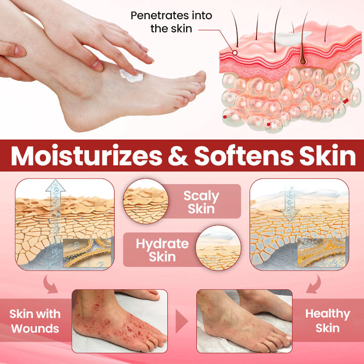 Timilk® VitaGluco Крем за грижа при диабет