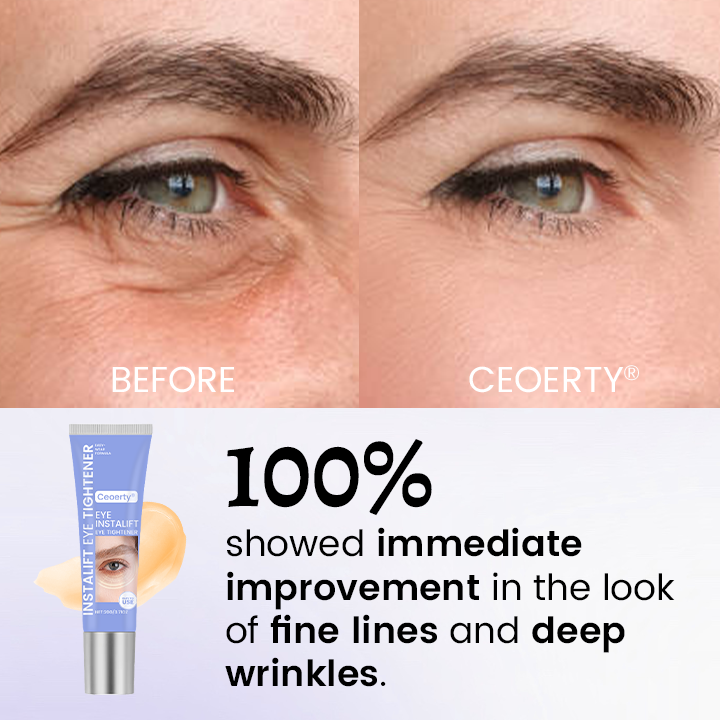 Ceoerty® InstaLift стягащ крем за очи – 10 секунди за по-млади и по-свежи очи
