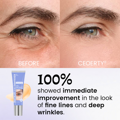 Ceoerty® InstaLift стягащ крем за очи – 10 секунди за по-млади и по-свежи очи