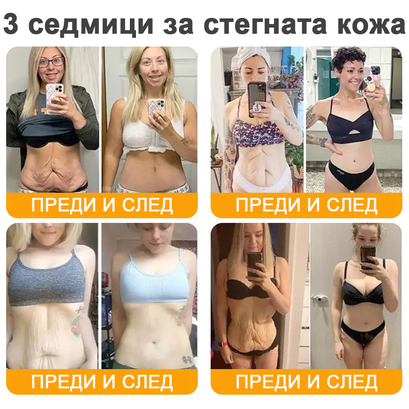 VLSVLS® Крем с пчелна отрова за регенерация на кожата (👨‍⚕️ подходящ за всички възрастови групи, препоръчан от AAD) 🎁