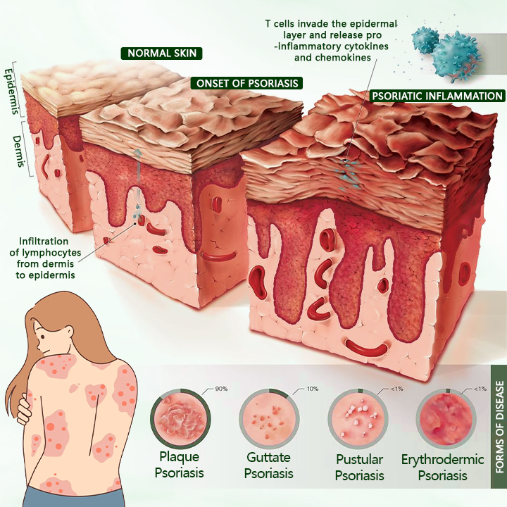 Timilk® DermaPure лечебен крем с чаено дърво