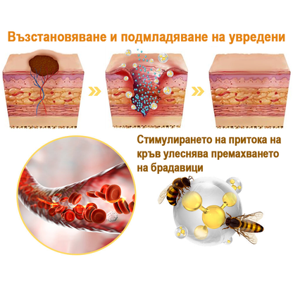 flysmus™ Спрей с пчелна отрова за премахване на кожни тагове и брадавици 🐝