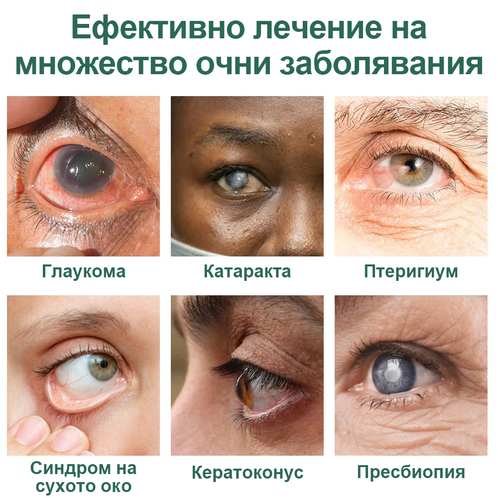 👩‍⚕️Ourlyard® Nano Eye Drops Serum ✅Одобрен от FDA (Подходящ за пресбиопия, синдром на сухото око, глаукома и катаракта) 👀