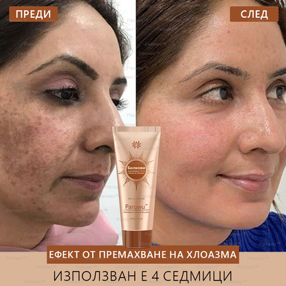 Parowu™ Изсветляваща и премахваща петна маска - 💗Натурални съставки за дълготрайно премахване на петна, хиперпигментации и слънчеви петна