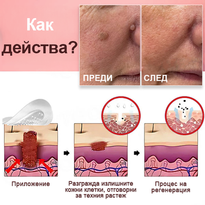 KUBOZN® Нано-микроиглени пластири за премахване на кожни етикети