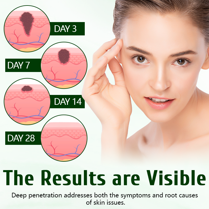 Timilk® DermaPure лечебен крем с чаено дърво