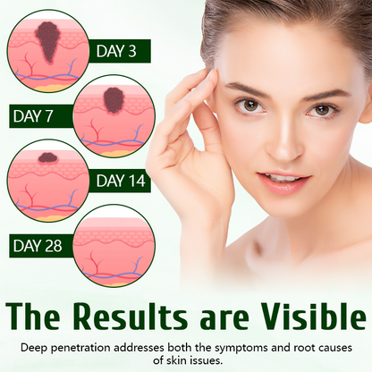 Timilk® DermaPure лечебен крем с чаено дърво