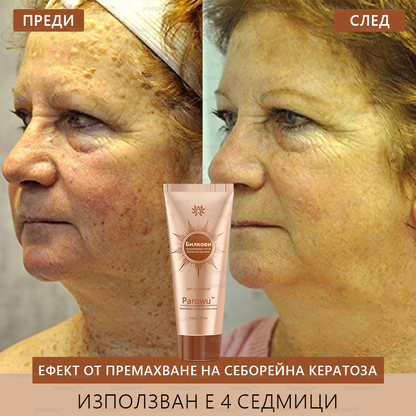 Parowu™ Изсветляваща и премахваща петна маска - 💗Натурални съставки за дълготрайно премахване на петна, хиперпигментации и слънчеви петна