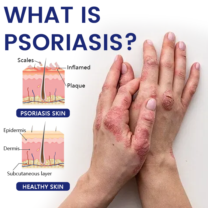 Възстановяващ крем Timilk® DermaSooth