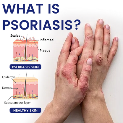 Възстановяващ крем Timilk® DermaSooth