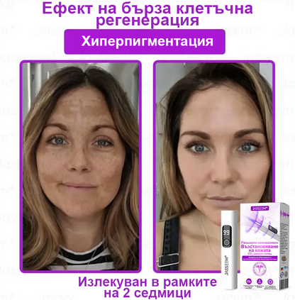 𝐉𝐚𝐬𝐬𝐞𝐞𝐦® Усъвършенствана неинвазивна CO₂ лазерна писалка за възстановяване на кожата 💕 (Нежно премахва брадавици, родилни белези, старчески петна и кожни образувания - без болка, без притеснения!)