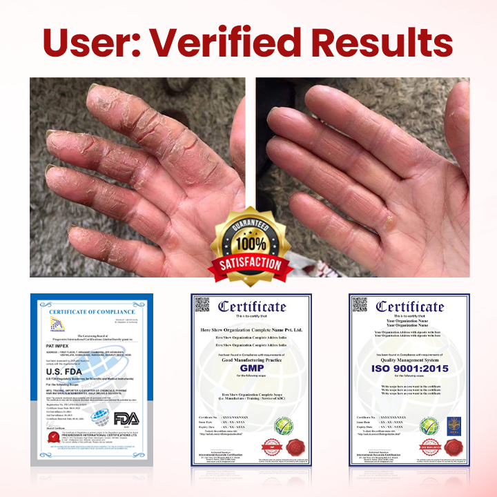 Timilk® VitaGluco Крем за грижа при диабет