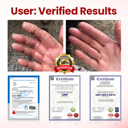 Timilk® VitaGluco Крем за грижа при диабет