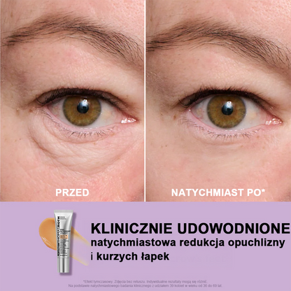 🌸Očný krém s okamžitým liftingom a ľahkou textúrou - maximálna pevnosť a hladký finiš ✨
