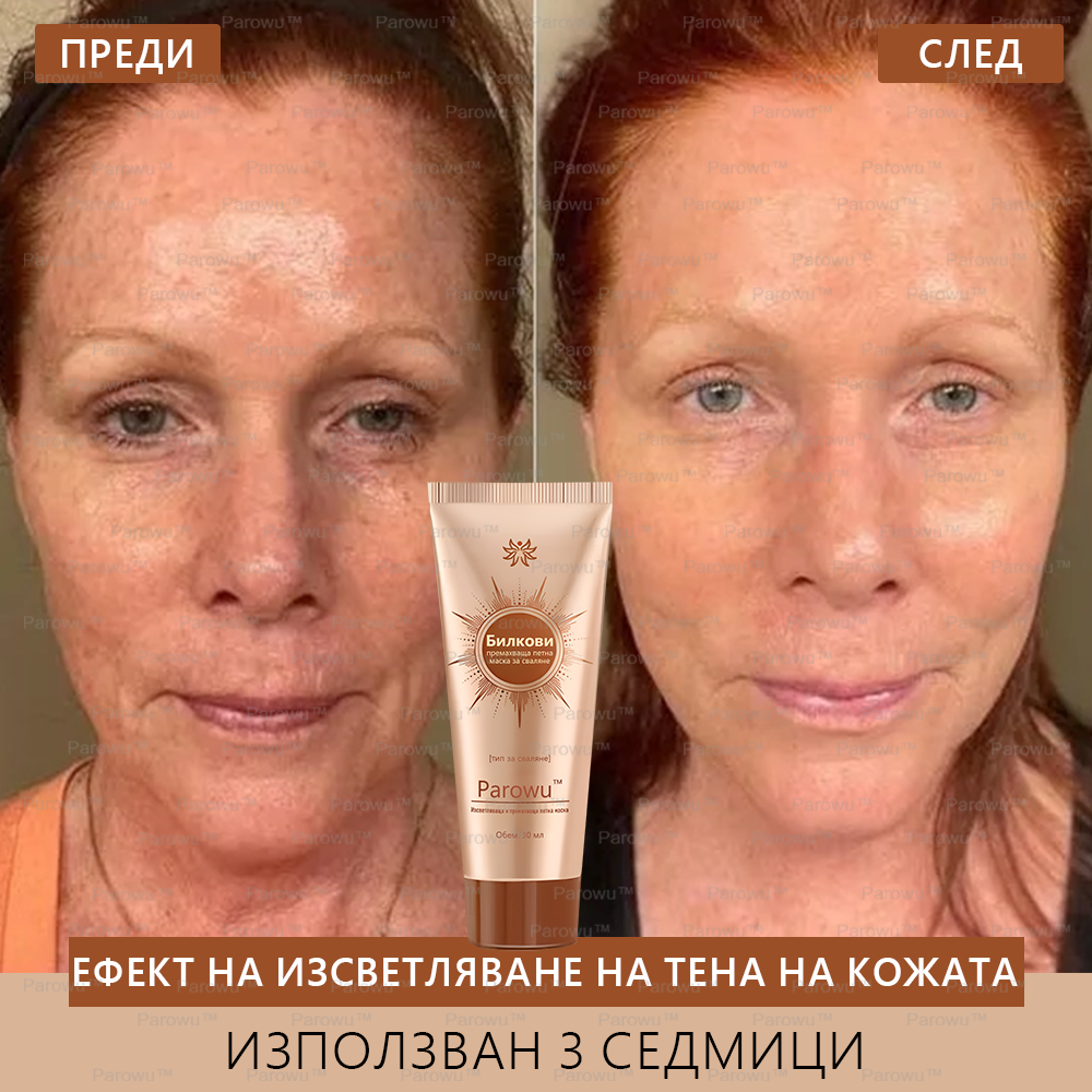 Parowu™ Изсветляваща и премахваща петна маска - 💗Натурални съставки за дълготрайно премахване на петна, хиперпигментации и слънчеви петна