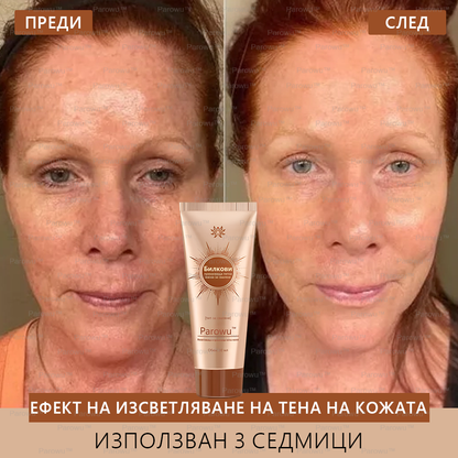 Parowu™ Изсветляваща и премахваща петна маска - 💗Натурални съставки за дълготрайно премахване на петна, хиперпигментации и слънчеви петна