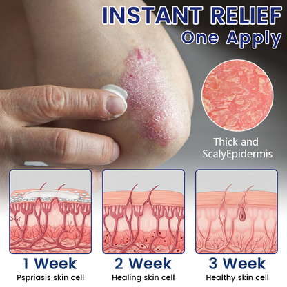 Възстановяващ крем Timilk® DermaSooth