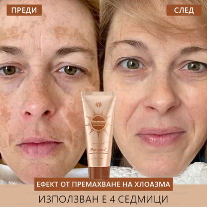 Parowu™ Изсветляваща и премахваща петна маска - 💗Натурални съставки за дълготрайно премахване на петна, хиперпигментации и слънчеви петна
