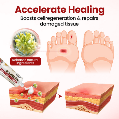 Timilk® VitaGluco Крем за грижа при диабет