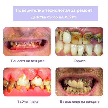 Cvreoz® (ADA recommended) Teeth Restoration Mineral Powder (🦷𝐋𝐢𝐦𝐢𝐭𝐞𝐝 𝐭𝐢𝐦𝐞 𝐝𝐢𝐬𝐜𝐨𝐮𝐧𝐭 𝐋𝐚𝐬𝐭 𝟑𝟎 𝐦𝐢𝐧𝐮𝐭𝐞𝐬🦷)💎