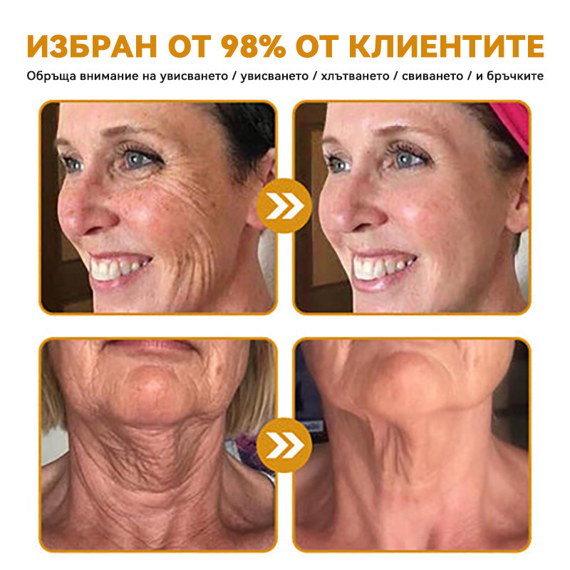 Официален представител на клиниката Майо:: 🦙𝐒𝐩𝐳𝐯™ Ботокс Пчелна отрова Крем за третиране на кожата, Хидратиране, възстановяване на кожата, изравняване на тена, лечение на акне и тъмни петна, премахване на брадавици и бенки, облекчаване на псориазис