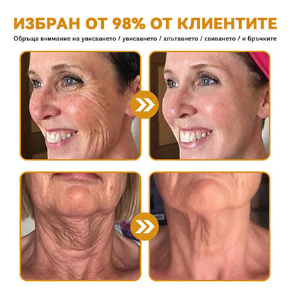 Официален представител на клиниката Майо:: 🦙𝐒𝐩𝐳𝐯™ Ботокс Пчелна отрова Крем за третиране на кожата, Хидратиране, възстановяване на кожата, изравняване на тена, лечение на акне и тъмни петна, премахване на брадавици и бенки, облекчаване на псориазис
