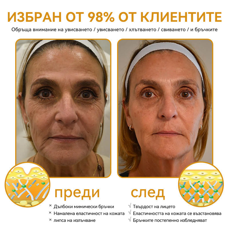 Официален представител на клиниката Майо:: 🦙𝐒𝐩𝐳𝐯™ Ботокс Пчелна отрова Крем за третиране на кожата, Хидратиране, възстановяване на кожата, изравняване на тена, лечение на акне и тъмни петна, премахване на брадавици и бенки, облекчаване на псориазис