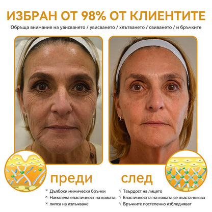 Официален представител на клиниката Майо:: 🦙𝐒𝐩𝐳𝐯™ Ботокс Пчелна отрова Крем за третиране на кожата, Хидратиране, възстановяване на кожата, изравняване на тена, лечение на акне и тъмни петна, премахване на брадавици и бенки, облекчаване на псориазис